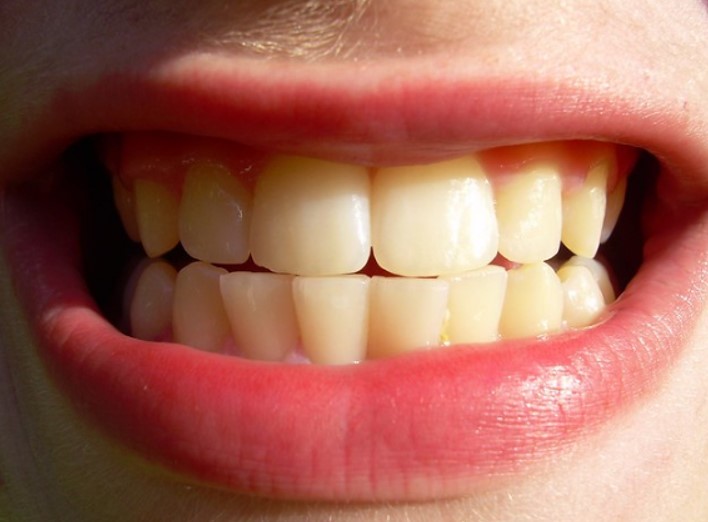 Tips to Keep Your Teeth and Gums Healthy